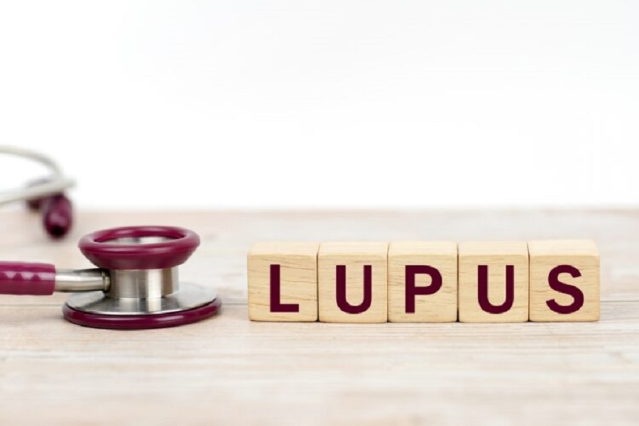 Word,Lupus,On,Wooden,Blocks,And,Stethoscope,On,The,Wooden