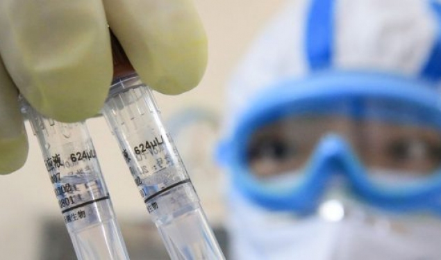 The suspected case of coronavirus in Peja has tested negative