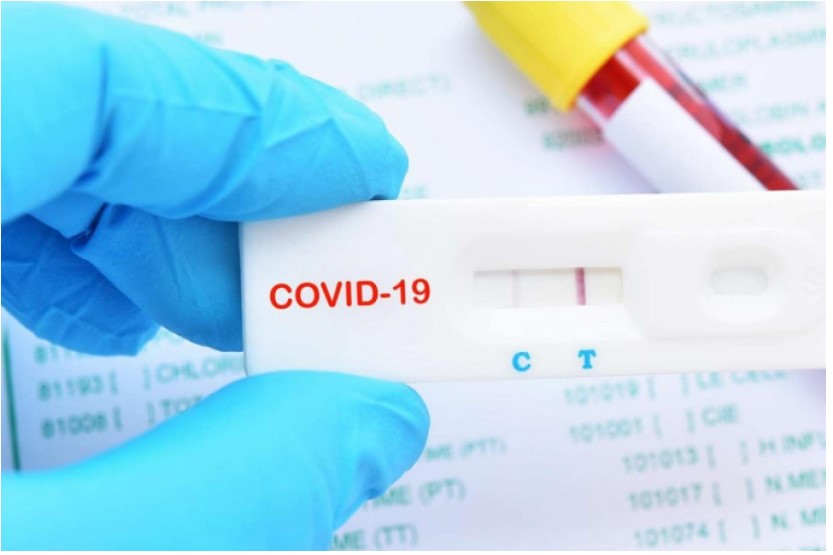 Two deaths due to COVID-19 today in Kosovo