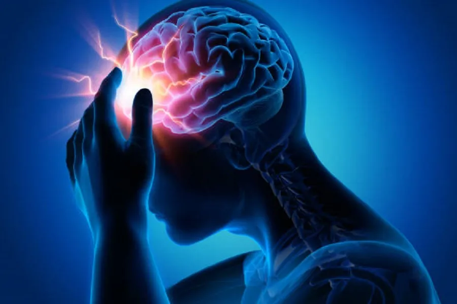 Severe Headache - Migraine - Medical Illustration - 3D Rendering